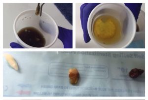 Что будет с зубами, если их опустить в безалкогольные напитки