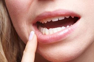 Нормально ли, если десны кровоточат во время чистки зубов?